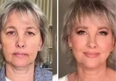 Debbie before and after using Leanhope Under-Eye Balm